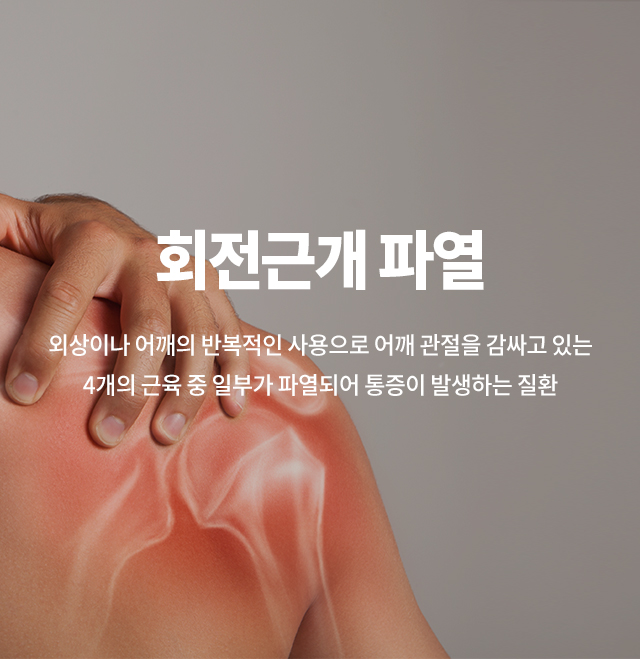 회전근개파열