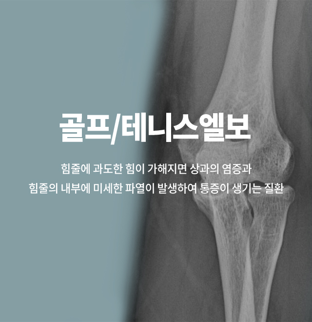 골프/테니스 엘보